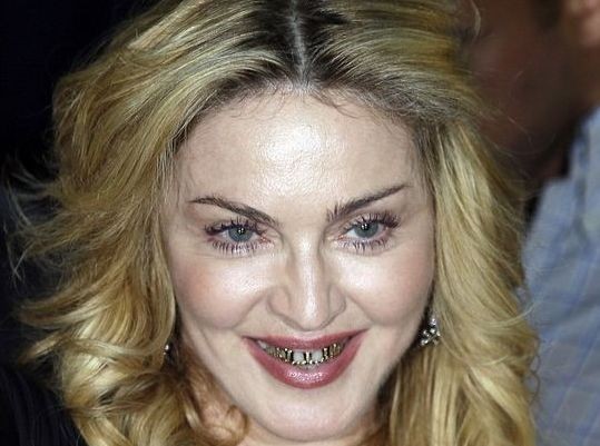Η Madonna με χρυσά σιδεράκια