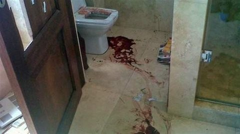 Βρέθηκε με κομμένο λαιμο μέσα στο μπάνιο της