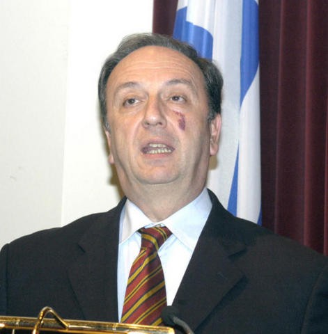 Πέθανε ο πρώην υπουργός Γιώργος Καλός
