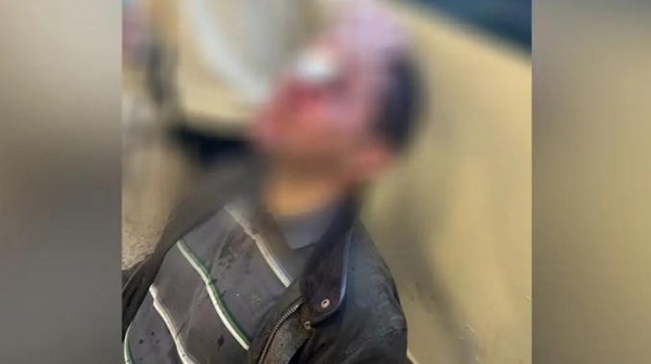 ΝΟΜΙΚΗ ΣΧΟΛΗ ΑΘΗΝΑΣ: Η αστυνομία σαρώνει τις κάμερες για τον εντοπισμό των 8 κουκουλοφόρων που χτύπησαν φοιτητή