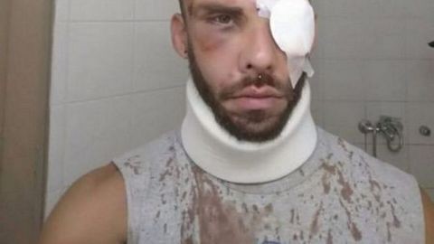 Αγριος ξυλοδαρμός νεαρού χωρίς λόγο και αιτία