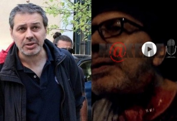 Ο Στέφανος Χίος μέσα στα αίματα περιγράφει την απόπειρα δολοφονίας του (VIDEO)