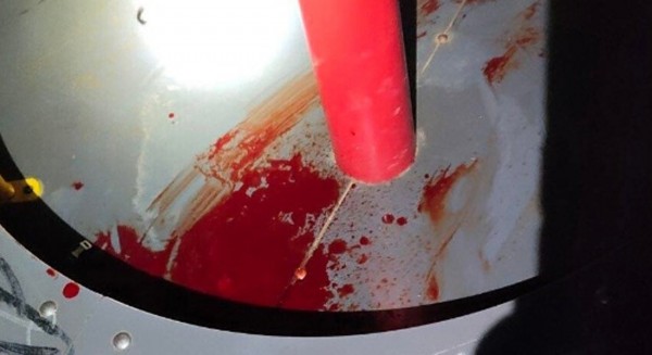 Σοκαριστικός τραυματισμός 15χρονης στη σβούρα παιδικής χαράς