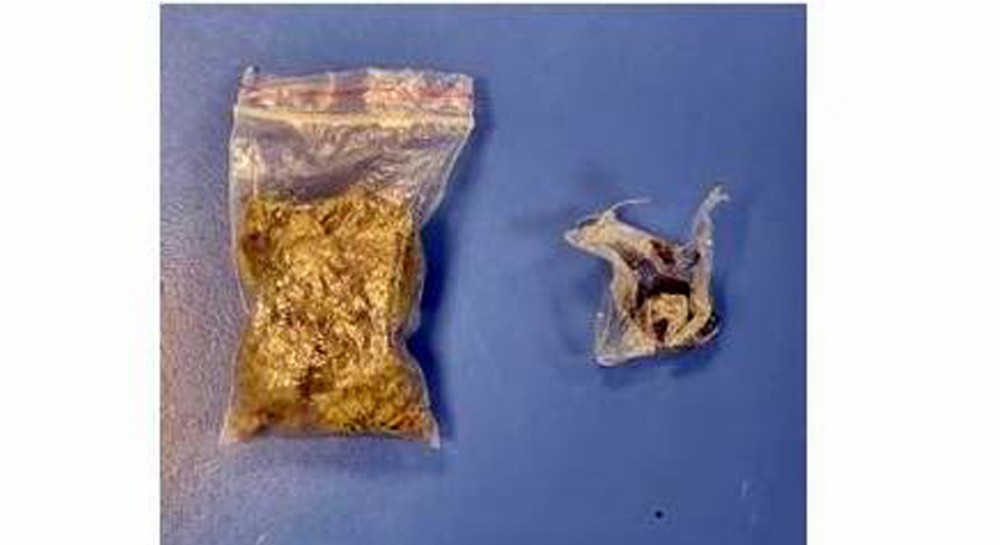 ΧΑΛΚΙΔΑ: Συνελήφθη 22χρονος για κατοχή ναρκωτικών από στελέχη του Λιμεναρχείου