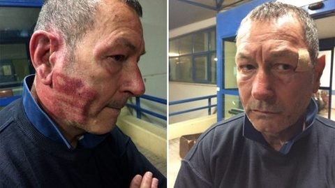 Αγνωστοι ξυλοκόπησαν τον Αντιδήμαρχο Θήβας Ανδρέα Χατζησταμάτη