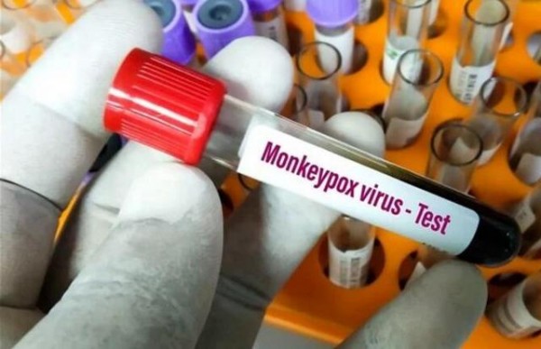 Ευλογιά των πιθήκων: Το πρώτο κρούσμα στη χώρα μας ανακοίνωσε ο ΕΟΔΥ