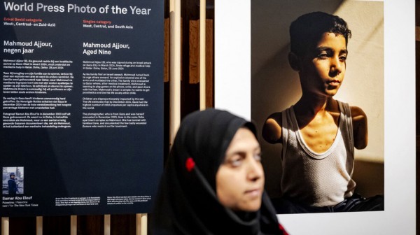 World Press Photo: Η φωτογραφία με ακρωτηριασμένο 9χρονο αγόρι από την Παλαιστίνη πήρε το πρώτο βραβείο για το 2025