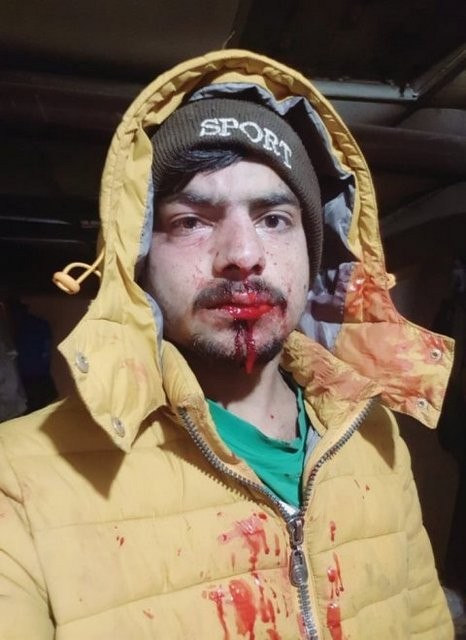 Κτηνοτρόφος ξυλοκόπησε άγρια δύο Πακιστανούς που ζητούσαν τα δεδουλευμένα τους