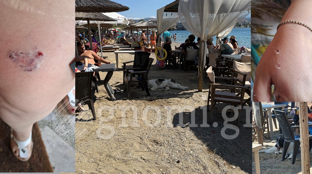 ΠΑΡΑΛΙΑ ΛΕΥΚΑΝΤΙ: Αδέσποτος σκύλος δάγκωσε τέσσερις λουόμενους!