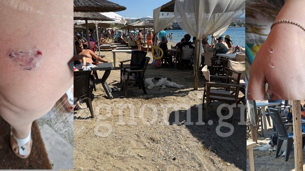 ΠΑΡΑΛΙΑ ΛΕΥΚΑΝΤΙ: Αδέσποτος σκύλος δάγκωσε τέσσερις λουόμενους!