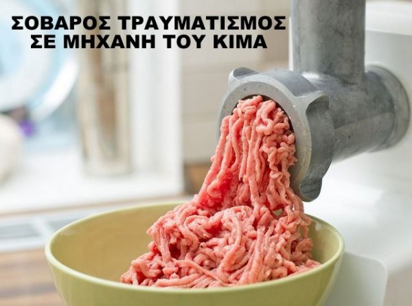 Τραυματίστηκε σοβαρά στο χέρι 15χρονος από μηχανή του κιμά