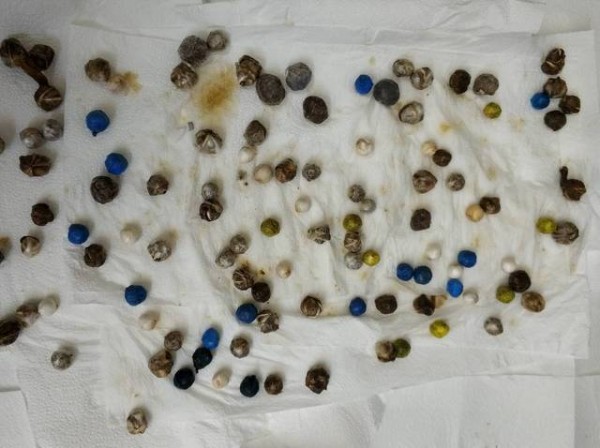 ΦΥΛΑΚΕΣ: Αυτά που βλέπετε είναι δόσεις ναρκωτικών, τις οποίες είχε καταπιεί κρατούμενος