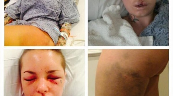 Τραγικό- Εσπασε στο ξύλο τη φίλη του η Μηχανή του Πολέμου