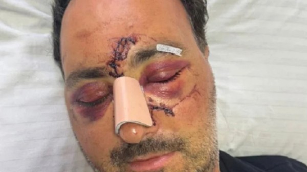 Άφαντοι οι Κρητικοί δράστες της άγριας επίθεσης στον Ελληνοκαναδό