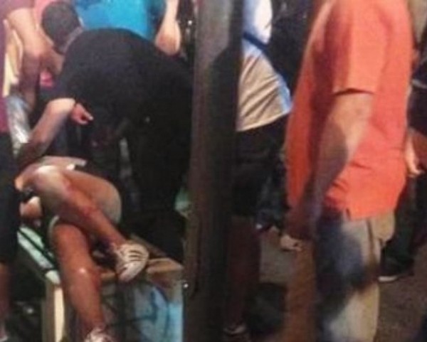 Eντοπίστηκε ο άνδρας που χτύπησε με φωτοβολίδα τη 19χρονη στο Αγρίνιο