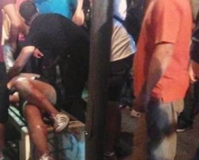 Eντοπίστηκε ο άνδρας που χτύπησε με φωτοβολίδα τη 19χρονη στο Αγρίνιο