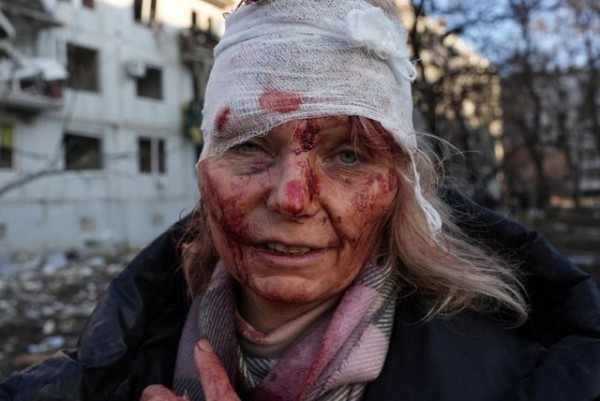 ΠΟΛΕΜΟΣ ΣΤΗΝ ΟΥΚΡΑΝΙΑ: Σε εξέλιξη το σφυροκόπημα της Ρωσίας - Νεκροί και τραυματίες