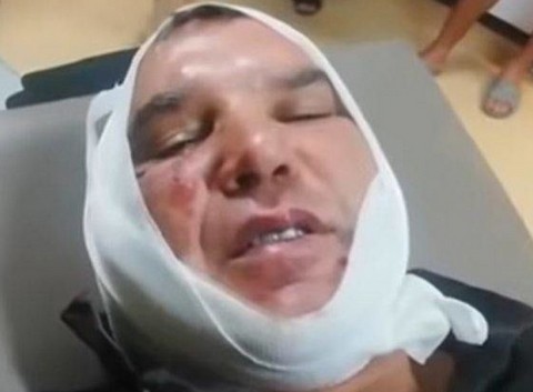 Αγριος καυγάς σε λαϊκή αγορά, δάγκωσαν και έκοψαν το αυτί παραγωγού (VIDEO)