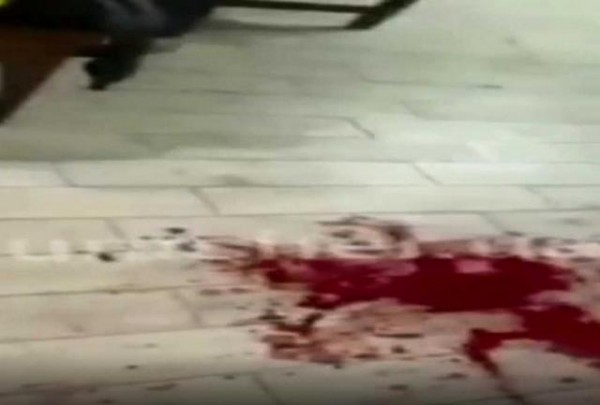Γκάφα του ΥΠΕΞ: Ένας νεκρός Ελληνας και όχι δύο από τα πυρά Ουκρανών στρατιωτών