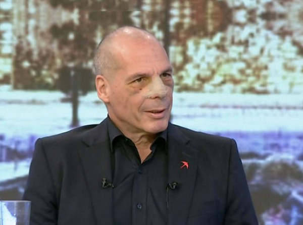 Βαρουφάκης: Η πρώτη εμφάνιση μετά τον ξυλοδαρμό του στα Εξάρχεια