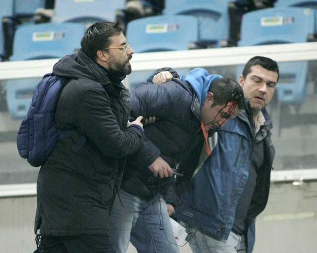 Δημοσιογράφος χτυπήθηκε με πέτρα στο κεφάλι