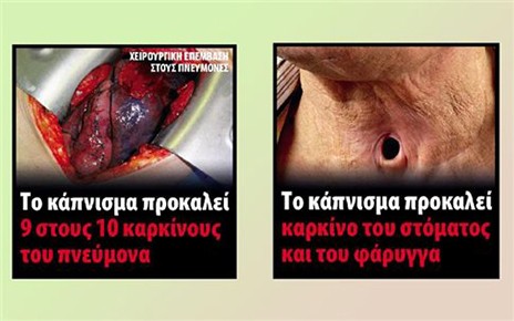 Πακέτα τσιγάρων με αποκρουστικές εικόνες