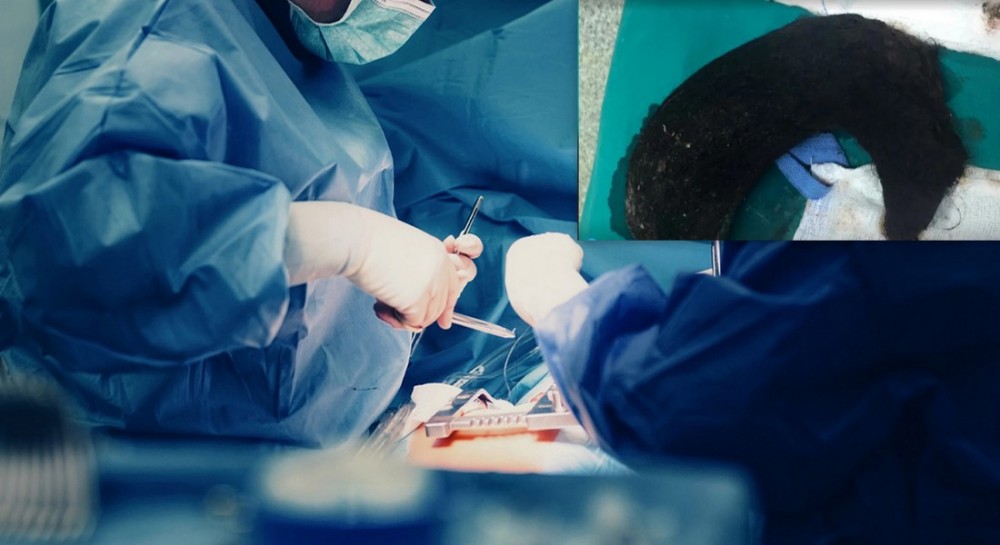 Χειρουργός παράτησε την επέμβαση γιατί δεν του σέρβιραν τσάι