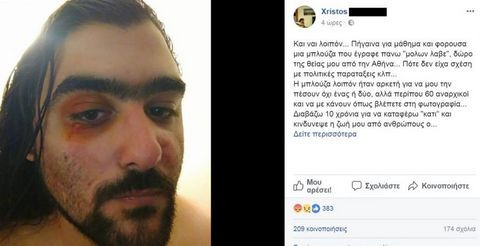 Ξυλοκοπήθηκε νεαρός ποδηλάτης επειδή φορούσε μπλούζα που έγραφε Μολών Λαβέ