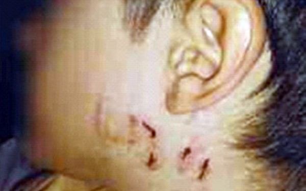 8χρονος έζησε εφιάλτη στα δόντια άγριου σκύλου