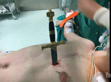 Χειρουργοί βγάζουν σπαθί καρφωμένο δίπλα στην καρδιά άντρα (VIDEO)