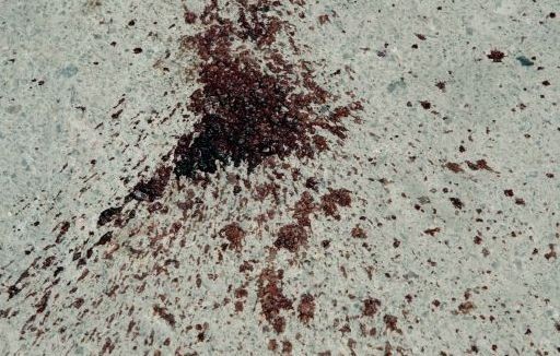 Χαλκίδα: Πέταξε από τον τρίτο όροφο τον αδερφό του