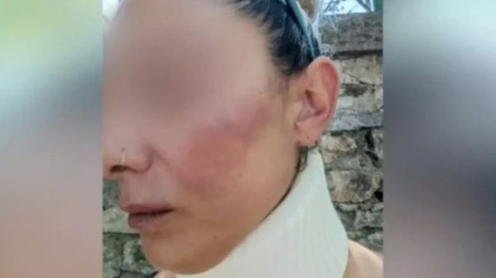 Συνελήφθη ο 36χρονος πυροσβέστης που ξυλοκόπησε την σύντροφό του στη Λέσβο (φωτό)