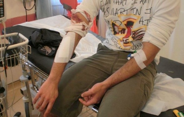 Επίθεση με σιδερολοστό σε 32χρονο από δύο νεαρούς