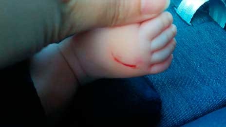 Συνελήφθη η μαυροφορεμένη γυναίκα που χαράκωνε μωρά στα νότια προάστια