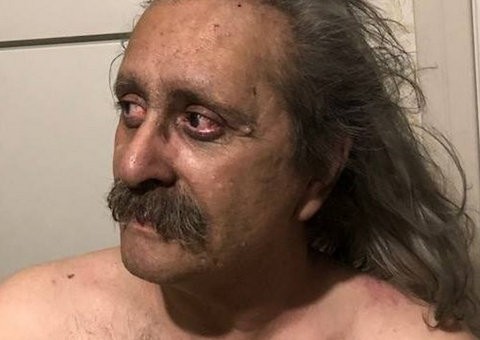 ΜΑΤΙ ΑΤΤΙΚΗΣ: Η σπαρακτική ανάρτηση ενός τυφλού που γλίτωσε από τον εφιάλτη της φονικής πυρκαγιάς